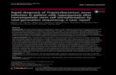 Rapid diagnosis of Propionibacterium acnes infection in ...€¦ · Keywords: Propionibacterium acnes, Hyperpyrexia, Hematopoietic stem cell transplantation, Next generation sequencing,