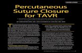 COVER STORY Percutaneous Suture Closure for TAVRv2.citoday.com/pdfs/cit0914_F1_Holper.pdfwith the Perclose ProGlide device. Given that the device was intended for suture-mediated closure
