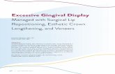 Excessive Gingival Display - AACD Professionals/jCD/Vol... · 46 20 Volume 36 Issue 2 Kenneth Valladares, DDS, CDT Paula Vargas, DDS, MBA Abstract Excessive gingival display, also