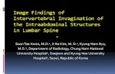 Image Findings of Intervertebral Invagination of the … · 2018. 5. 16. · Image Findings of Intervertebral Invagination of the Intraabdominal Structures in Lumbar Spine Soon Tae