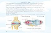 Meniscus Tear · 2020. 8. 26. · Meniscus tears can come in many different sizes and varieties, including bucket handle tears, radial tears, longitudinal tears, horizontal tears,