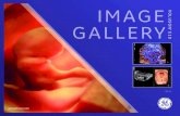 IMAGE VOLUSON GALLERY E10...BT21 IMAGE GALLERY gehealthcare.com 23 week fetal profile 26 week fetal abdominal vasculature rendered with HD live Flow HD live Silhouette rendering of