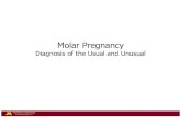 Molar Pregnancy · 2020. 10. 29. · clue is repeat molar pregnancy mutations in NLRP7 and KHD3CL • Many reported disease causing mutations –often a compound heterozygote (acts