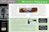 Brain Waves - Le Bonheur Children's Hospital › dotAsset › e9014ef0-6fbd-4...An important goal in neurosurgery is to remove pathological brain tissue, while limiting post-surgical