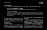 Case Report Pelvic Myxoid Leiomyoma Mass between Vagina … · 2019. 7. 30. · Pelvic Myxoid Leiomyoma Mass between Vagina and Rectum OmarAlShalabi,FadiObaiedAlahmar,HazemAljasem,