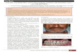 Annals of Dental Specialty · 2020. 6. 21. · Condylar hyperplasia is a complex deformity of temporomandibular joint which involves excessive growth of condyle. Asymmetric facial