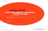 eSie VVI...eSie VVI Velocity Vector Imaging Technology – 2D Speckle Tracking 2. Technology eSie VVI technology achieves robust wall motion analysis by utilizing advanced speckle