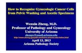 How to Recognize Gynecologic Cancer Cells from Pelvic Washing … · 2019. 11. 19. · Neoadjuvant Chemotherapy Give chemotherapy prior to “debulking’ surgery. Started from two