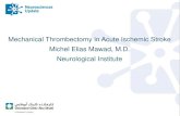 Mechanical Thrombectomy in Acute Ischemic Stroke Michel Elias … · 2018. 2. 13. · Michel Elias Mawad, M.D. Neurological Institute . TIMELY ANTEGRADE REPERFUSION < 6 HOURS PHARMACOLOGICAL