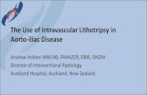The Use of Intravascular Lithotripsy in Aorto-iliac Disease · Shockwave IVL in AIOD: Auckland Experience • Shockwave IVL to facilitate TEVAR/EVAR –4 cases • Shockwave IVL to
