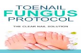 TOENAIL FUNGUS · Nail fungus is also called by its medical term, onychomycosis, whereas the infected nails have a condition that starts as a yellow or white spot under the tip of