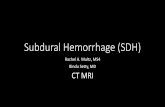Subdural Hemorrhage (SDH) - Boston University