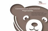 Craniosynostosis and Positional Plagiocephaly