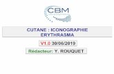 CUTANE : ICONOGRAPHIE ERYTHRASMA V1.0 30/06/2019 ...