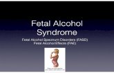 Fetal Alcohol Syndrome - sps186.org