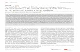 ARTICLE OPEN An Ad/MVA vectored Theileria parva schizont ...