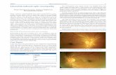 Linezolid‑induced optic neuropathy On examination, his ...