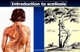 Introduction to scoliosis - Bangalore Spine Clinic