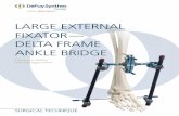 Large externaL Fixator— DeLta Frame ankLe BriDge