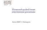 Ultrasound-guided breast interventional procedures