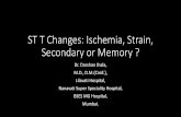 ST T Changes: Ischemia, Secondary,Memory or Something else