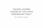 PLEURAL LESIONS LESIONS OF THE UPPER RESPIRATORY TRACT