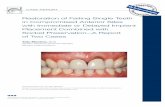 Restoration of Failing Single Teeth in Compromised Anterior Sites