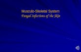 Musculo-Skeletal System Fungal Infections of the Skin