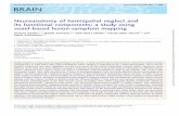 Neuroanatomy of hemispatial neglect and its functional - Brain