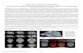 MEMRI Atlas of Neonatal Mouse Brain Development Fig. 1 - ismrm