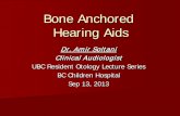 Bone Anchored Hearing Aids - WordPress.com