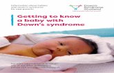 Getting to know a baby with Down’s syndrome