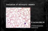 Evaluation of microcytic anaemia - The University of the ...