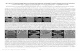The value of two-dimensional gradient echo imaging (2D-GRE ...