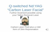 Q-switched Nd:YAG “Carbon Laser Facial”