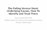 The Failing Venous Stent: Underlying Causes, How To ...