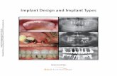 Implant Design and Implant Types