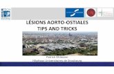 LÉSIONS AORTO-OSTIALES TIPS AND TRICKS