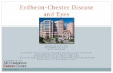 Erdheim-Chester Disease and Eyes