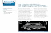 Ultrasound High-frequency transducers and MFI HD enhance ...
