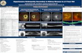 Hypertensive Retinopathy Secondary to Kidney Disease in a ...