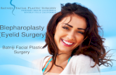 Blepharoplasty| Eyelid Surgery in Newport Beach, CA