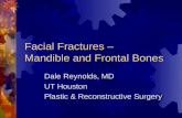 Facial Fractures – Mandible and Frontal Bones Dale Reynolds, MD UT Houston Plastic & Reconstructive Surgery.
