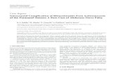 Intracranial Complication of Rhinosinusitis from ... Intracranial Complication of Rhinosinusitis from