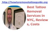 Best tattoo removal services in nyc, reviews, costs